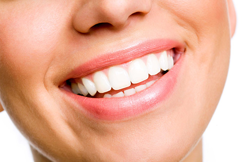 Mise en forme cosmétique gingivale | Dent Smile