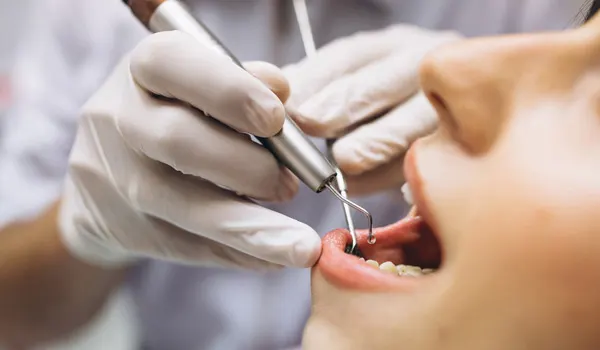 Türkiye Dental Implants